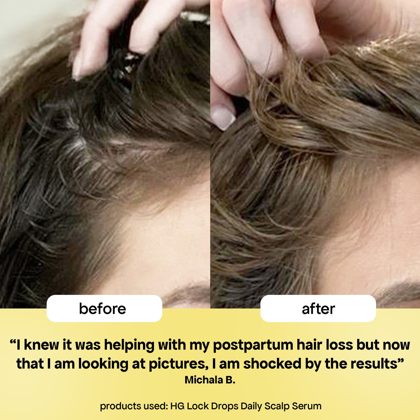 LOCK DROPS ANTI-SHEDDING SCALP & HAIR SERUM