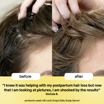 LOCK DROPS ANTI-SHEDDING SCALP & HAIR SERUM