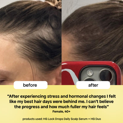 ANTI-THINNING BEST SELLER