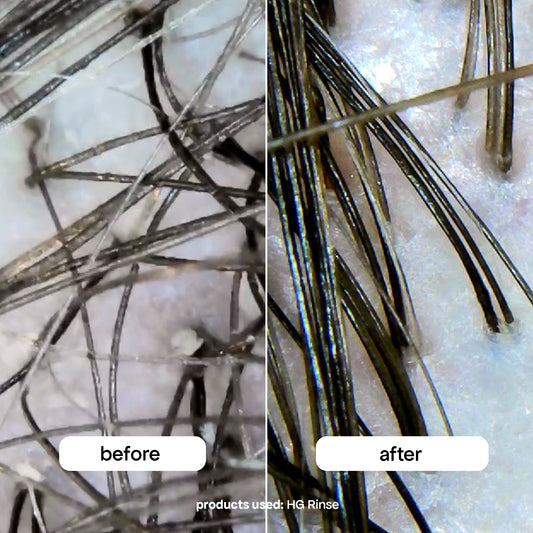 CLARIFYING SCALP & HAIR RINSE